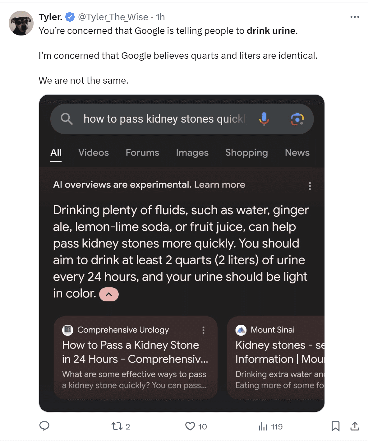 AI Overview suggests that people suffering from a kidney stone should drink a human bodily fluid and also conflates quarts with liters.
